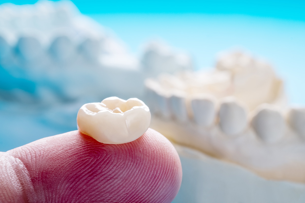 Durable, natural-looking crowns crafted in general dentistry for long-term success.