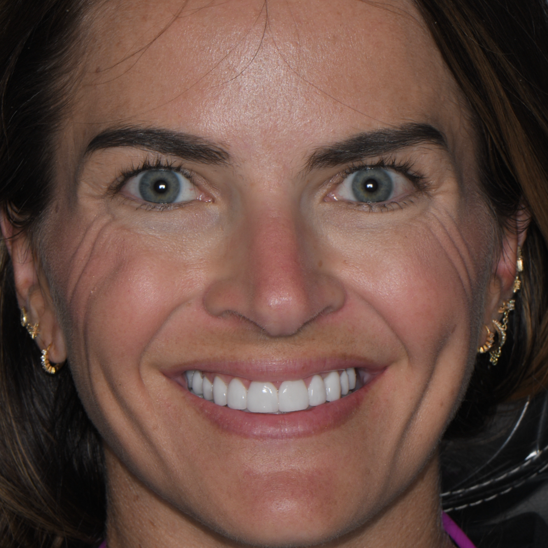 After receiving exceptional care at Moore Dental Arts.